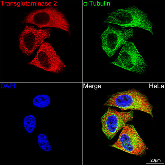 Transglutaminase 2 (TGM2) Rabbit monoclonal antibody