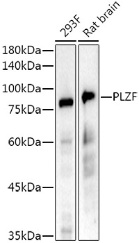 PLZF Rabbit monoclonal antibody