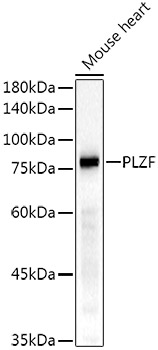 PLZF Rabbit monoclonal antibody