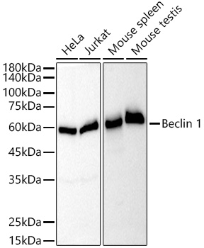 [KO Validated] Beclin 1 Rabbit monoclonal antibody