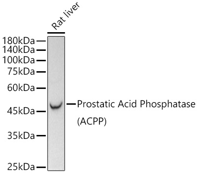 Prostatic Acid Phosphatase (PSAP) Rabbit monoclonal antibody