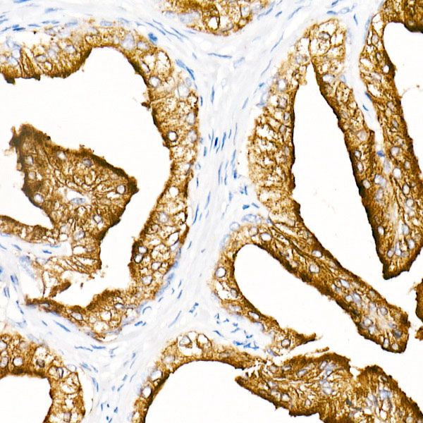 Prostatic Acid Phosphatase (PSAP) Rabbit monoclonal antibody