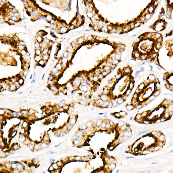 Prostatic Acid Phosphatase (PSAP) Rabbit monoclonal antibody