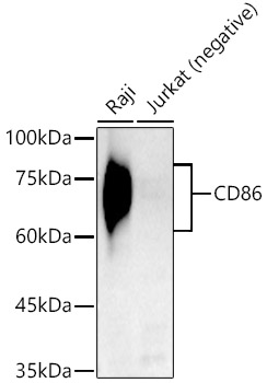 CD86 Rabbit monoclonal antibody