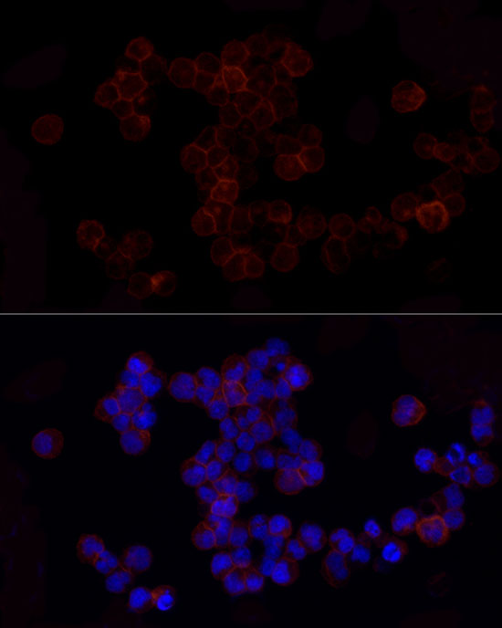 CD86 Rabbit monoclonal antibody