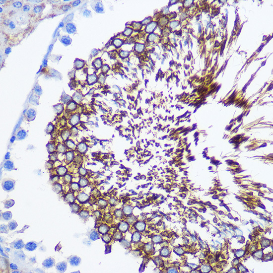 SPAM1 Rabbit polyclonal antibody