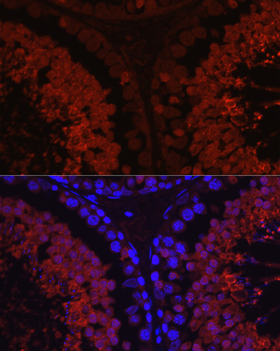 SPAM1 Rabbit polyclonal antibody
