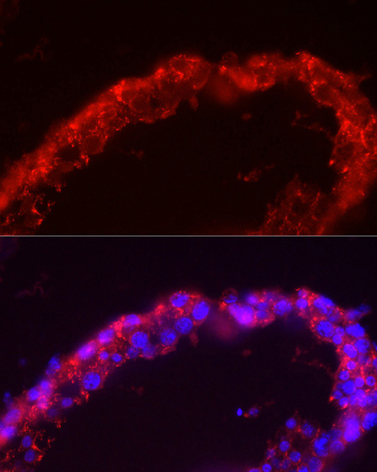 SPAM1 Rabbit polyclonal antibody