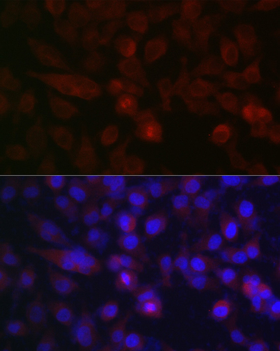 AURKA Rabbit polyclonal antibody