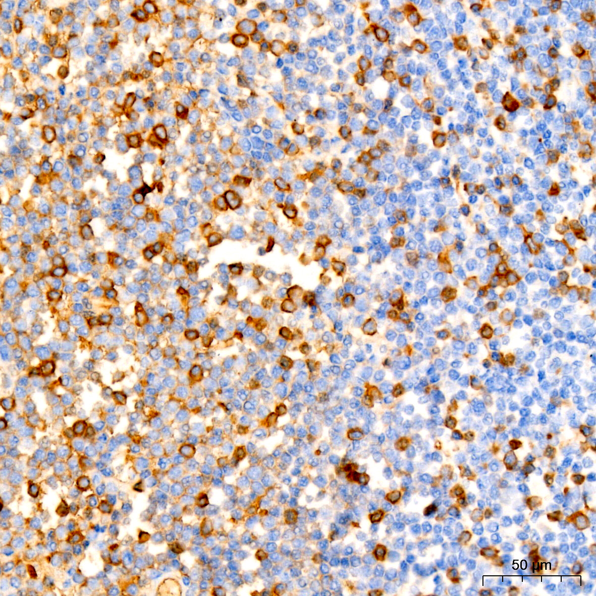 human IgG (Fc) Mouse monoclonal antibody