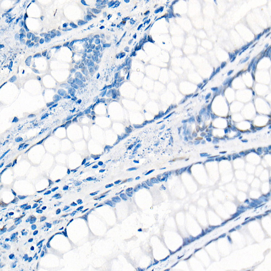 [KO Validated] YAP1 Rabbit monoclonal antibody