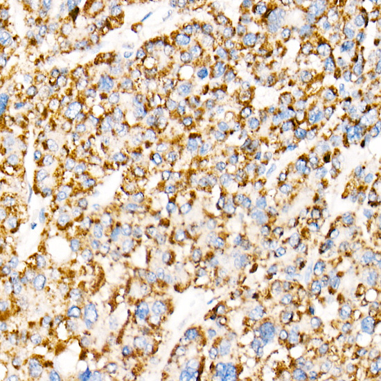 ACOX1 Rabbit monoclonal antibody