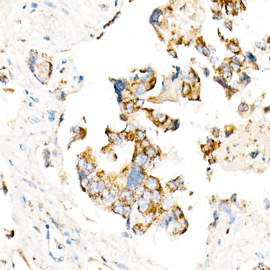 ACOX1 Rabbit monoclonal antibody