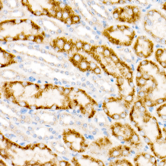 ACOX1 Rabbit monoclonal antibody