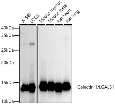 Galectin 1/LGALS1 Rabbit monoclonal antibody