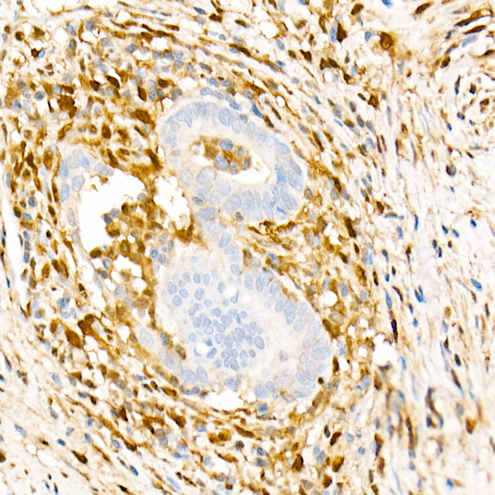 Galectin 1/LGALS1 Rabbit monoclonal antibody