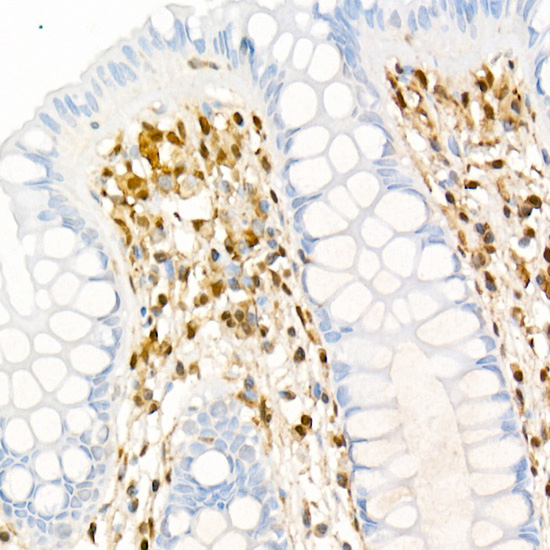 Galectin 1/LGALS1 Rabbit monoclonal antibody
