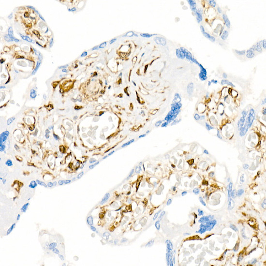 Galectin 1/LGALS1 Rabbit monoclonal antibody