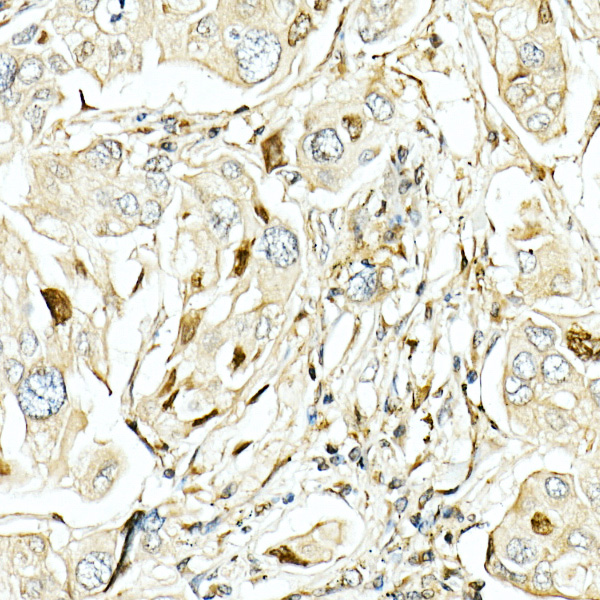 LKB1 Rabbit polyclonal antibody