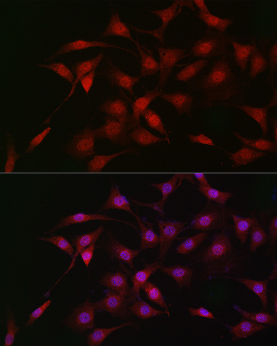 LKB1 Rabbit polyclonal antibody