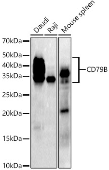 CD79B Rabbit monoclonal antibody