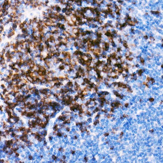 CD79B Rabbit monoclonal antibody