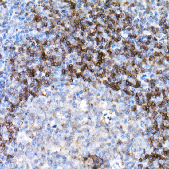 CD79B Rabbit monoclonal antibody