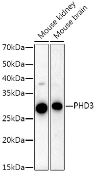 PHD3 Rabbit monoclonal antibody