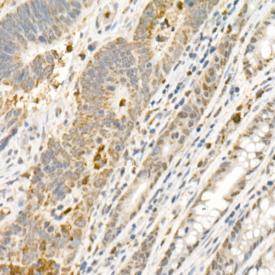 PHD3 Rabbit monoclonal antibody