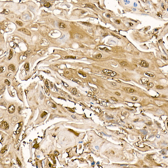 PHD3 Rabbit monoclonal antibody