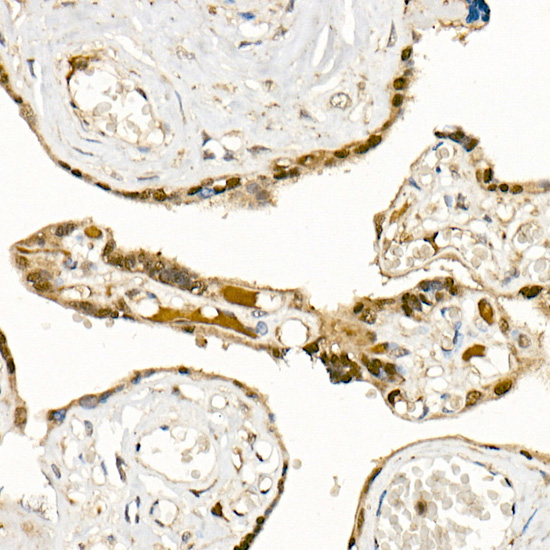 PHD3 Rabbit monoclonal antibody