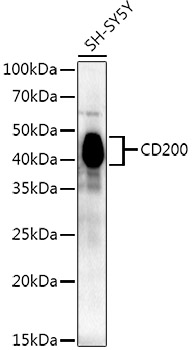 CD200 Rabbit monoclonal antibody