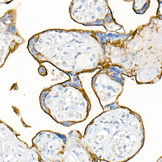 CD200 Rabbit monoclonal antibody