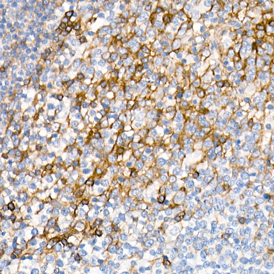 CD200 Rabbit monoclonal antibody