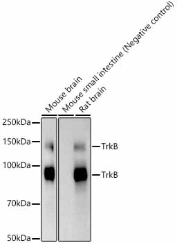 TrkB Rabbit monoclonal antibody