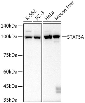 STAT5A Rabbit mAb