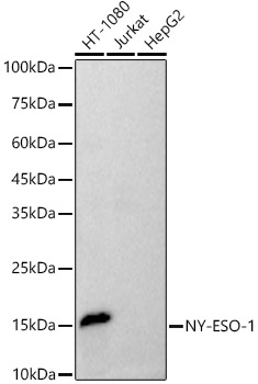 NY-ESO-1 Rabbit monoclonal antibody