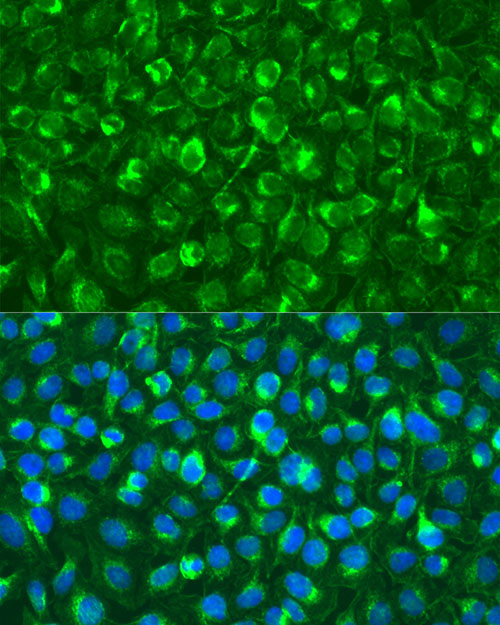 Syk Rabbit polyclonal antibody