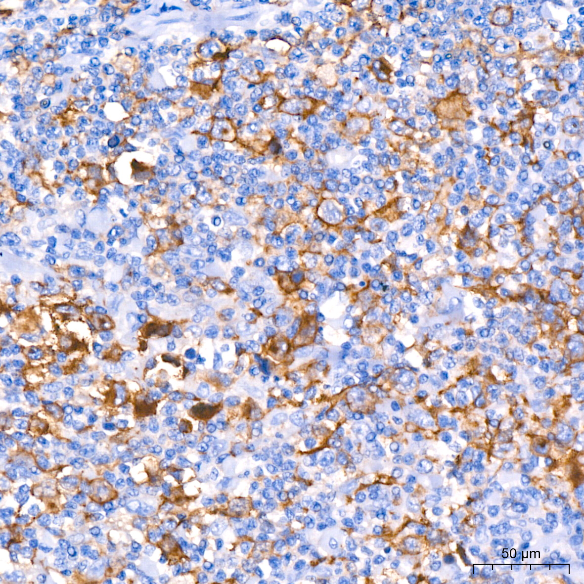 CD30 Rabbit monoclonal antibody