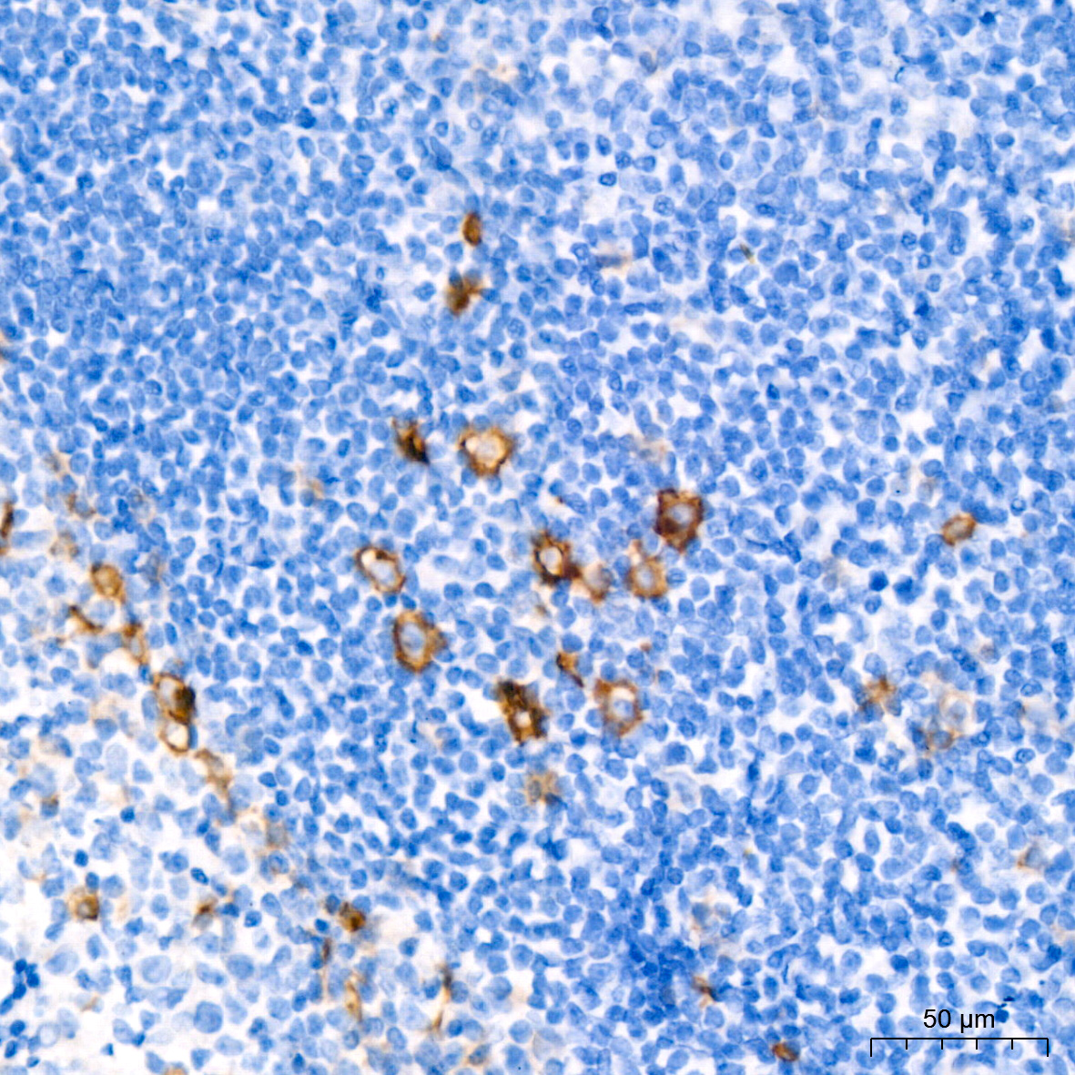 CD30 Rabbit monoclonal antibody