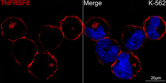 CD30 Rabbit monoclonal antibody