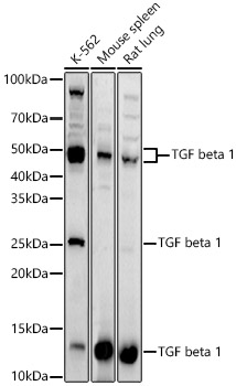 TGF beta 1 Rabbit polyclonal antibody
