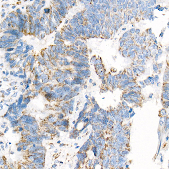 COX7A1 Rabbit monoclonal antibody