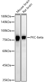 PKC-beta Rabbit monoclonal antibody