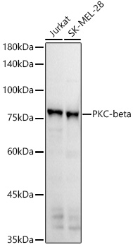PKC-beta Rabbit monoclonal antibody