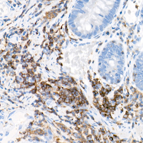 PKC-beta Rabbit monoclonal antibody