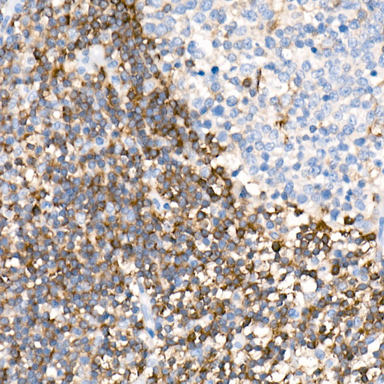 PKC-beta Rabbit monoclonal antibody