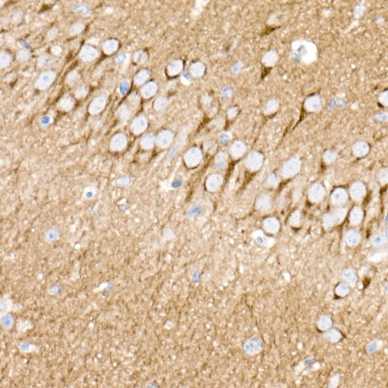 PKC-beta Rabbit monoclonal antibody