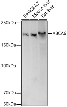 Western blot analysis of various lysates using [KD Validated] ABCA6 Rabbit pAb (A21243) at 1:1000 dilution.<br/>Secondary antibody: HRP-conjugated Goat anti-Rabbit IgG (H+L) (AS014) at 1:10000 dilution.<br/>Lysates/proteins: 25μg per lane.<br/>Blocking buffer: 3% nonfat dry milk in TBST.<br/>Detection: ECL Basic Kit (RM00020).<br/>Exposure time: 10s.