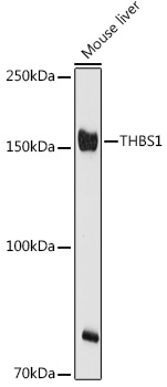 THBS1 Rabbit polyclonal antibody